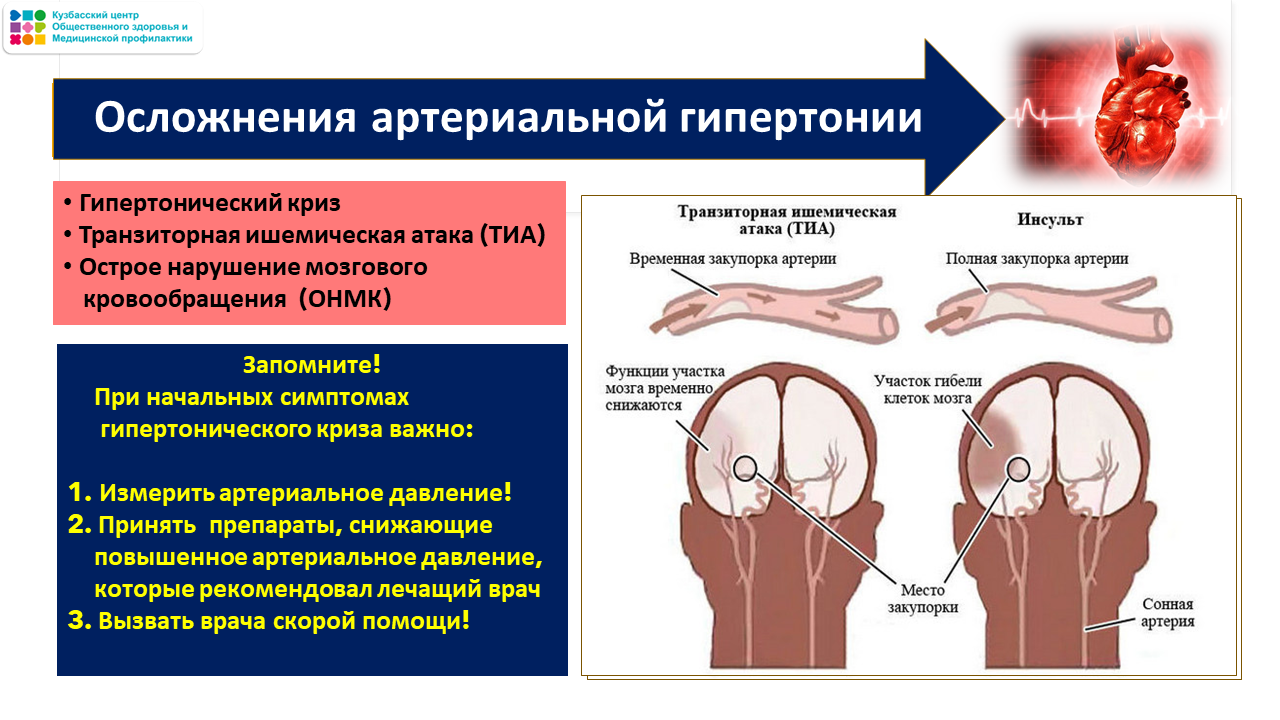 Неделя ответственного отношения к сердцу 23-29.09 Слайд27