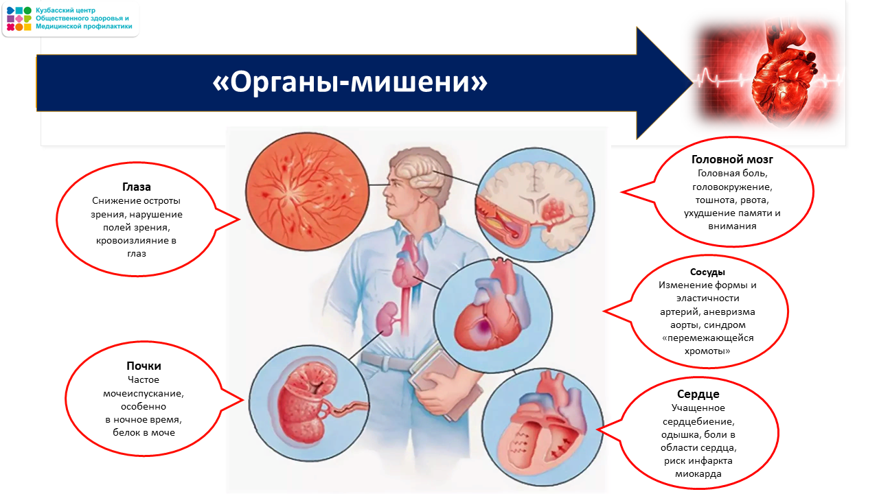 Неделя ответственного отношения к сердцу 23-29.09 Слайд28