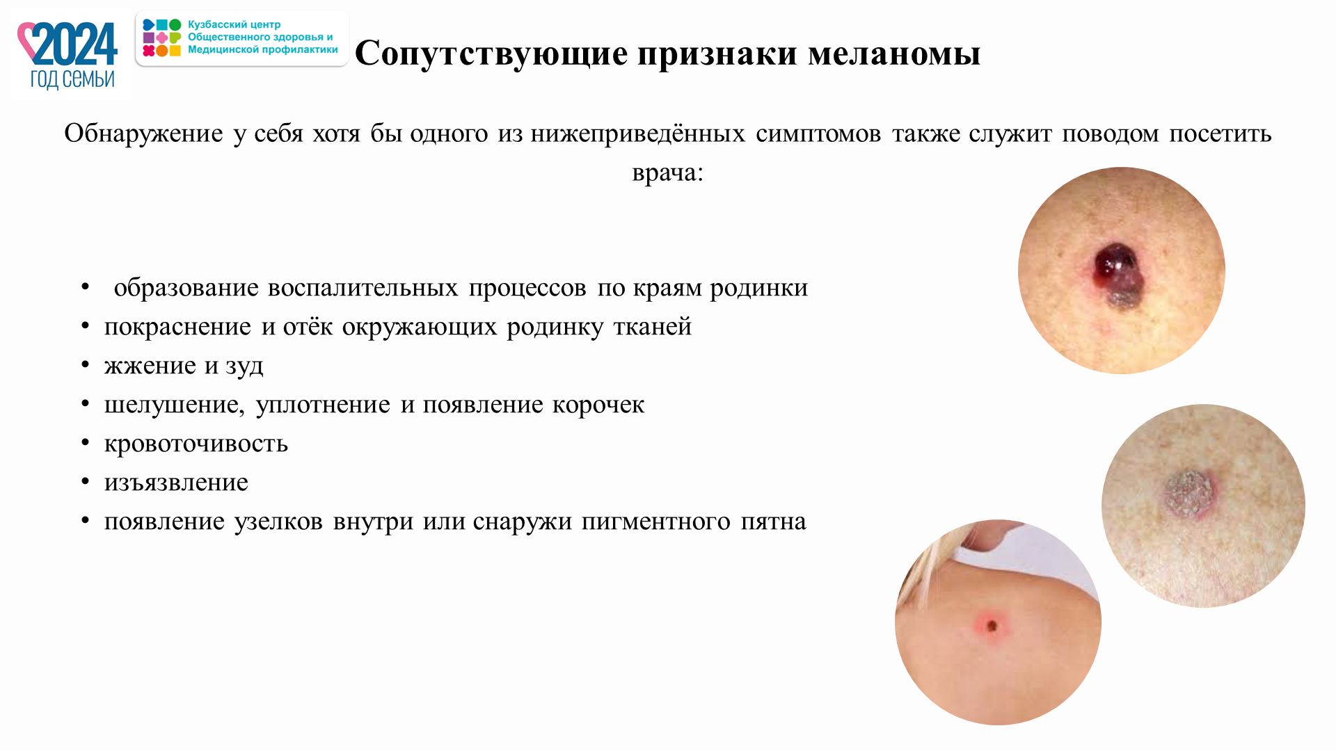 Неделя профилактики кожных заболеваний 02-08.09 Слайд19